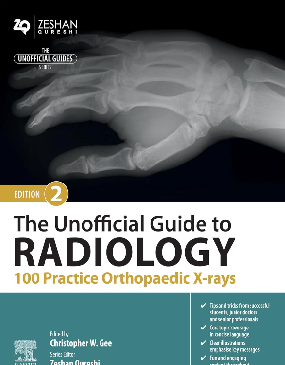 The Unofficial Guide to Radiology: 100 Practice Orthopaedic X-rays